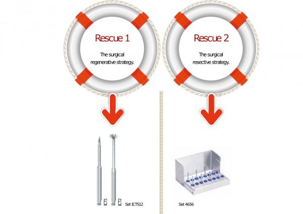 perii de periimplantita